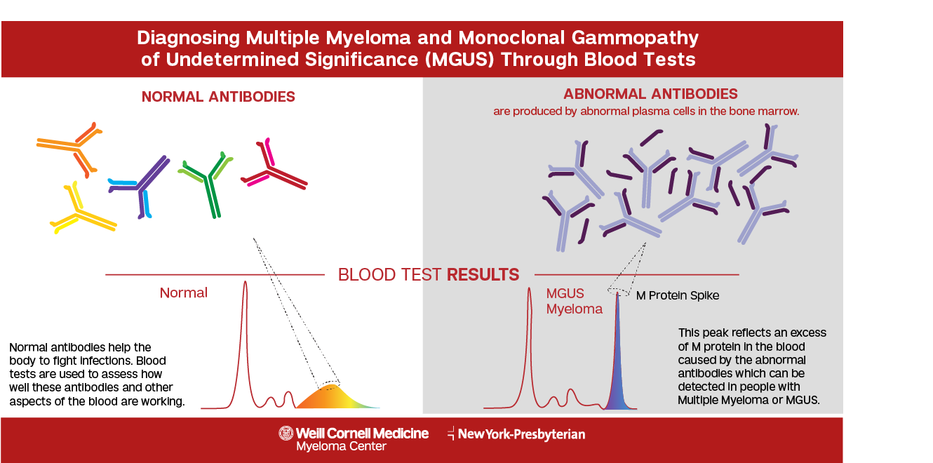 blood test for myeloma